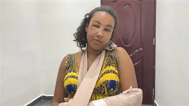 Mujer denuncia agresión física en Las Terrenas por tres desconocidos