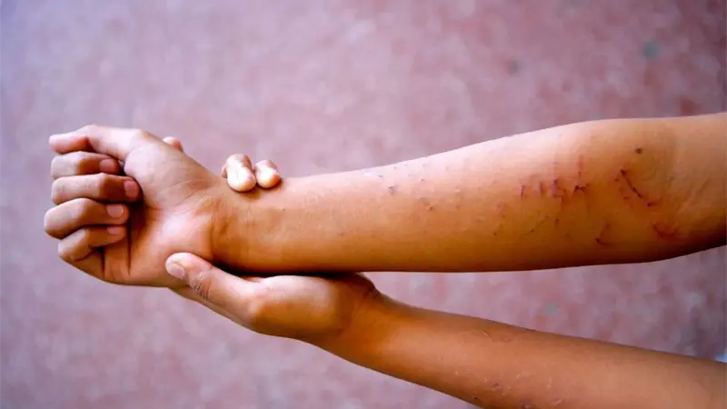 Unicef afirma que m&aacute;s del 63 % de los ni&ntilde;os dominicanos ha sufrido violencia en el hogar