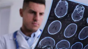 D&iacute;a Internacional de la Epilepsia: Control de casos resistentes al tratamiento