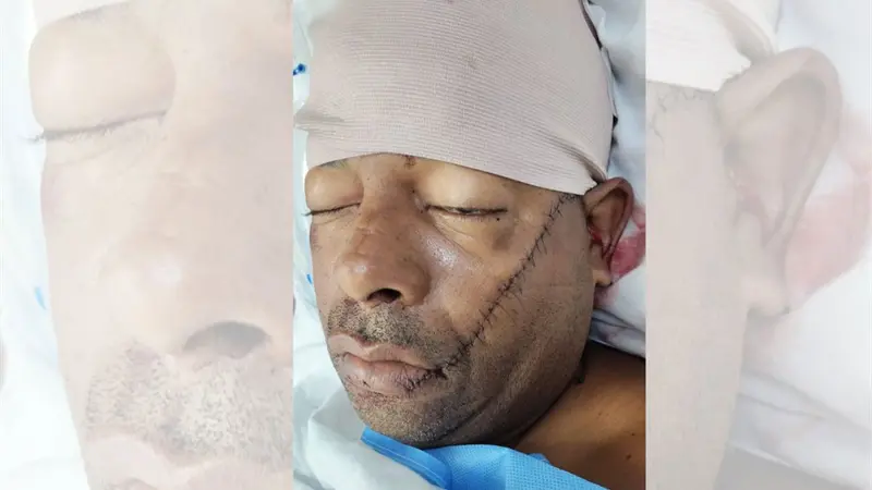 Dos hombres resultan heridos tras violento enfrentamiento por juego de domin&oacute; en Monte Plata