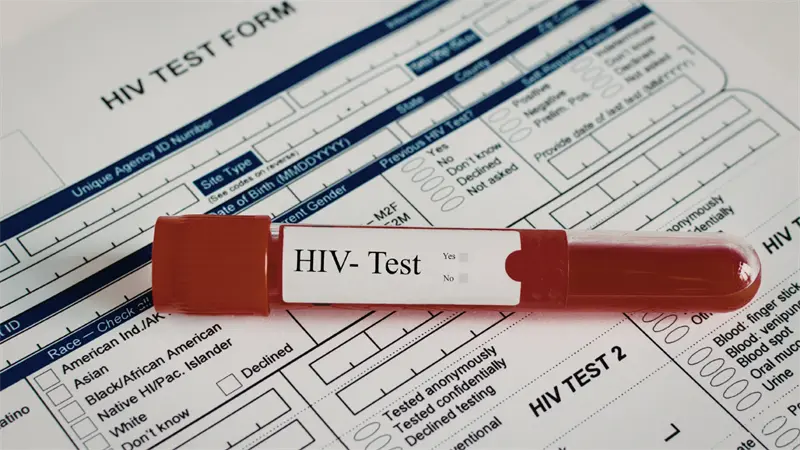 La Rep&uacute;blica Dominicana enfrenta una epidemia de VIH, advierte la OPS