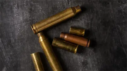 Ni&ntilde;o de 10 a&ntilde;os es herido de bala en San Francisco de Macor&iacute;s