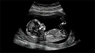 Puerto Rico rechaza ley que tipifica como asesinato muerte de concebido no nacido