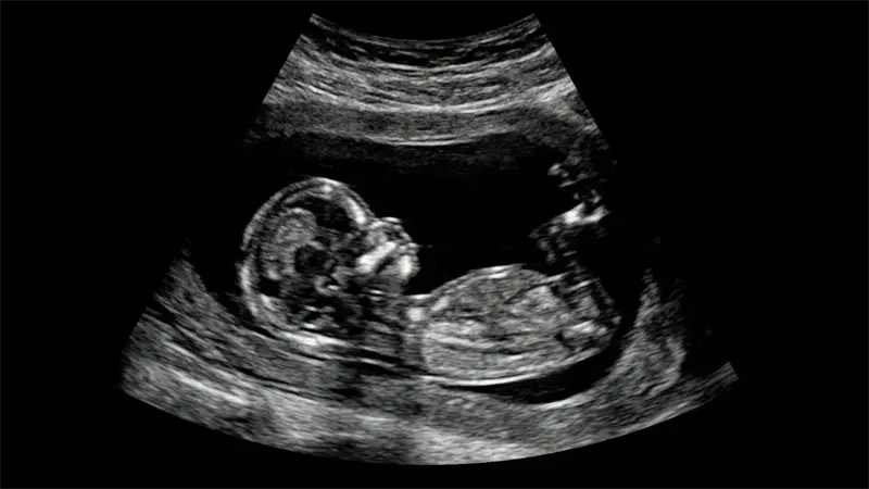 Puerto Rico rechaza ley que tipifica como asesinato muerte de concebido no nacido