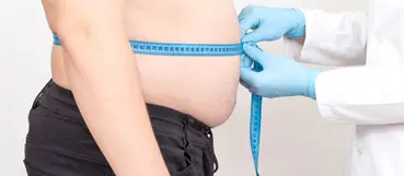 Especialista llama a tratar la obesidad como enfermedad cr&oacute;nica