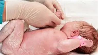 Reci&eacute;n nacidos con malformaciones cong&eacute;nitas abdominales: claves para su detecci&oacute;n y tratamiento