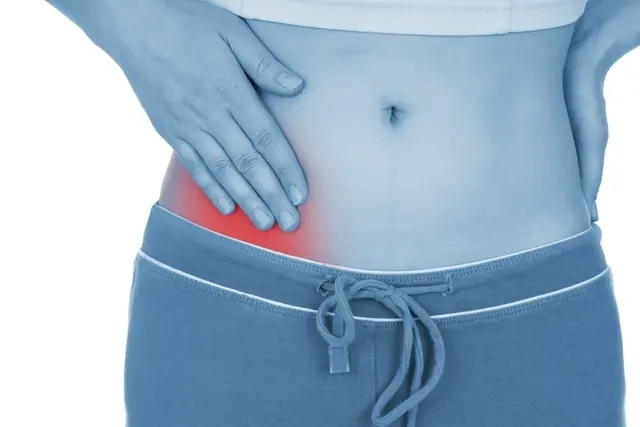 Los quistes de ovario hemorrágicos y cómo tratarlos