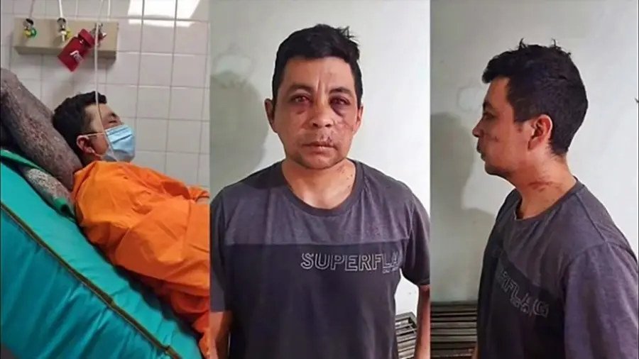 Vecinos golpean, roban y queman la casa de enfermero que tuvo Covid-19