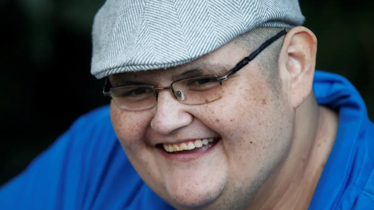 El mexicano que fue el más obeso del mundo alista reconstrucción de su cuerpo