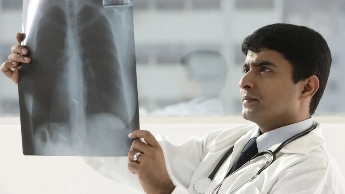 Estudios actuales sobre el cáncer de pulmón