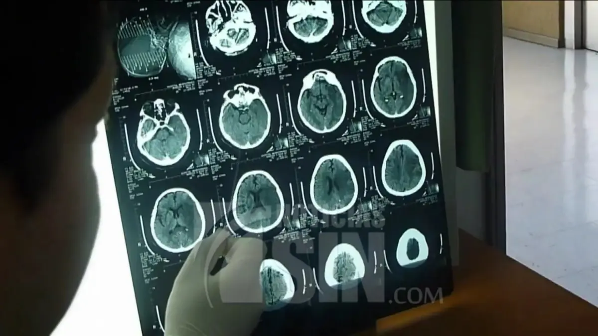 Serie de dolencias en nuestro cerebro a raíz de la pandemia