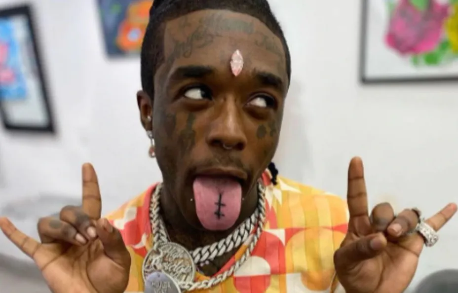 Fanáticos le arrancan de la frente el diamante de 24 millones que se incrustó Lil Uzi Vert
