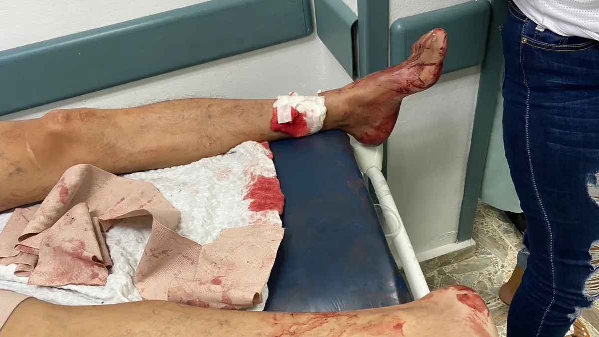 Video: Desconocidos hieren de varios disparos a vendedor de frutas y le llevan pistola y dinero