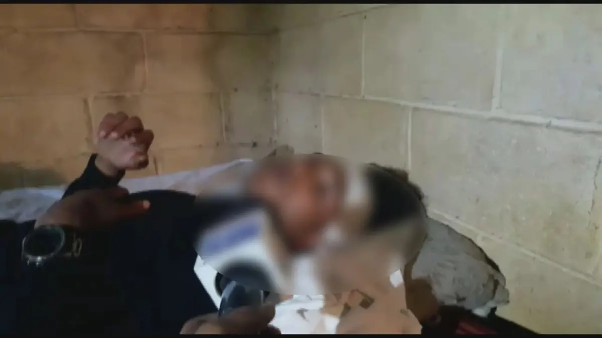 Adolescente es atacado a machetazos por supuesta expareja de vecina