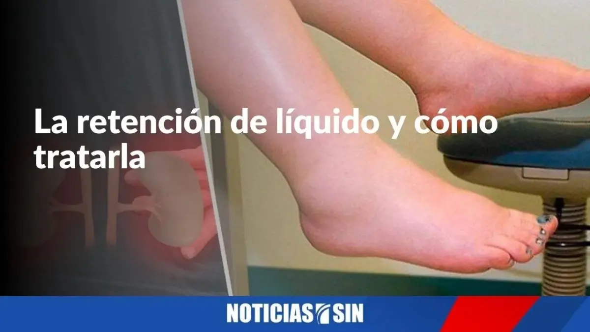La retención de líquido y cómo tratarla