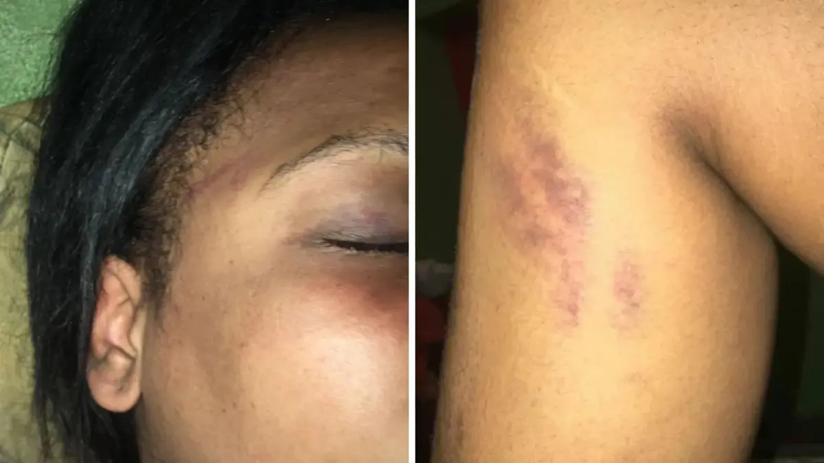 Temo por mi vida y la de mi hijo: mujer denuncia es agredida por expareja