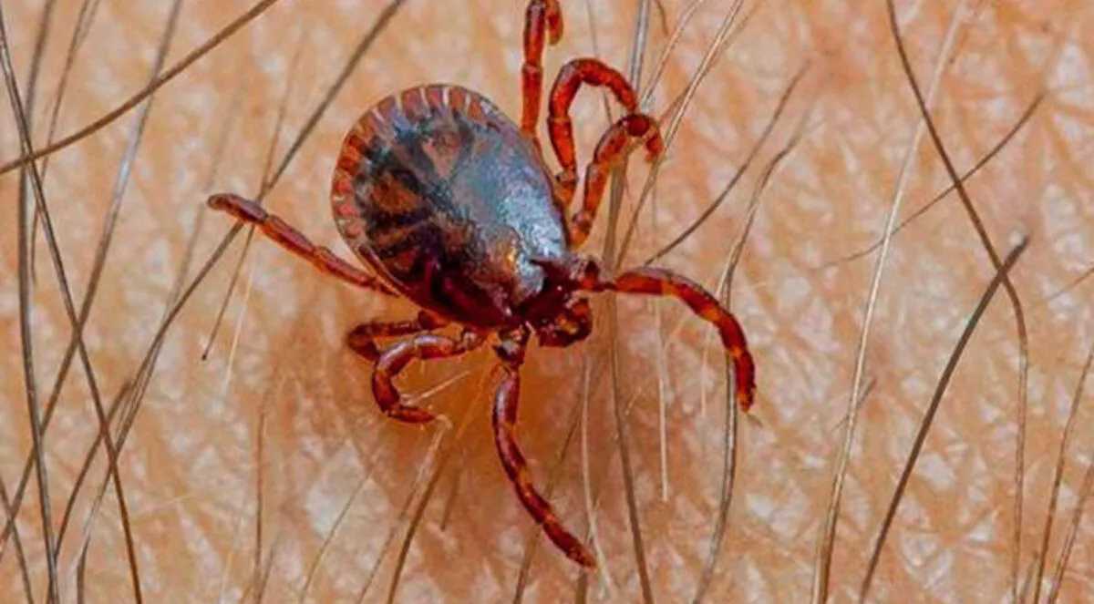 Si vas al campo, ¡cuidado con la picadura de garrapata!
