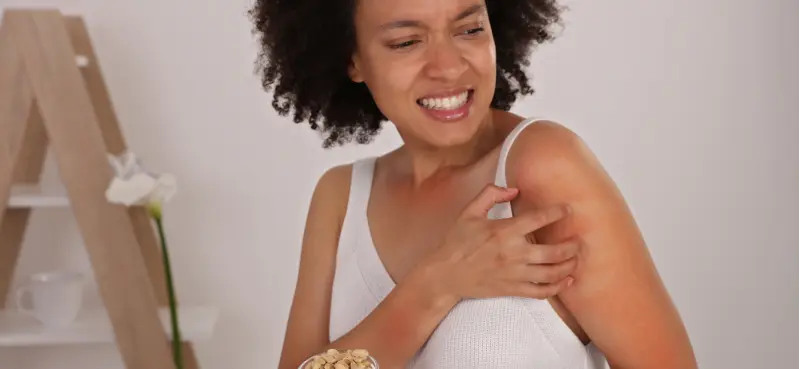 Aproximadamente el 50% de la población sufre de alergias; Durante el verano, este padecimiento podría aumentar