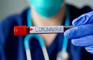 Coronavirus: Autoridades de Salud reportan 409 nuevos casos