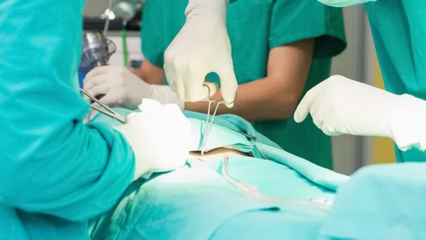 Inquietudes sobre la Esterilización quirúrgica