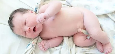 ¿Cuándo se debe operar una hernia umbilical en un bebé?