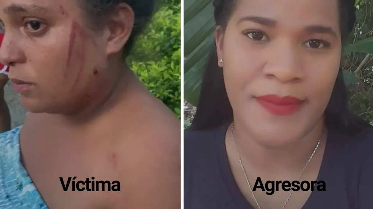 Mujer embarazada de ocho meses pierde bebé tras golpes que le propinó su cuñada