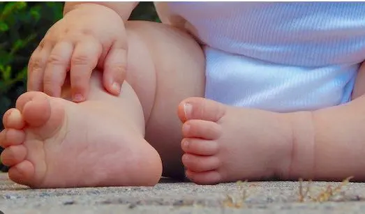 Recomiendan esperar 18 meses del bebé para ver si mal formación en pies se corrige por si solo