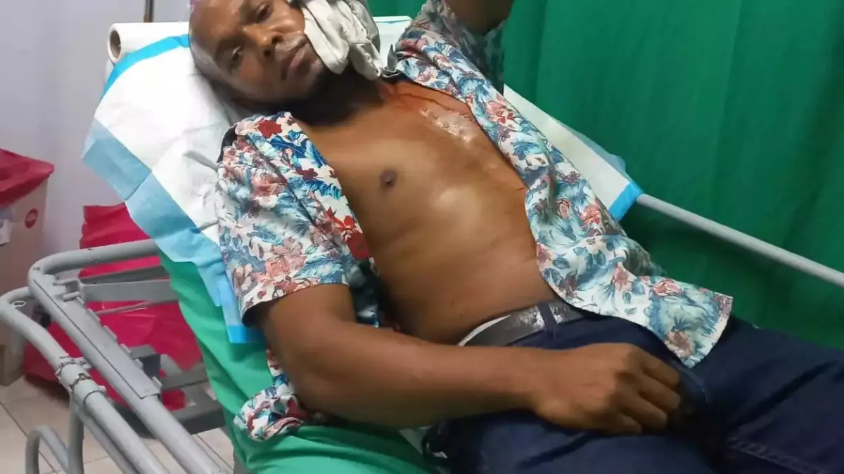 Policía Nacional apresa mujer “limpiavidrios” agredió en la cabeza a camarógrafo de noticiero