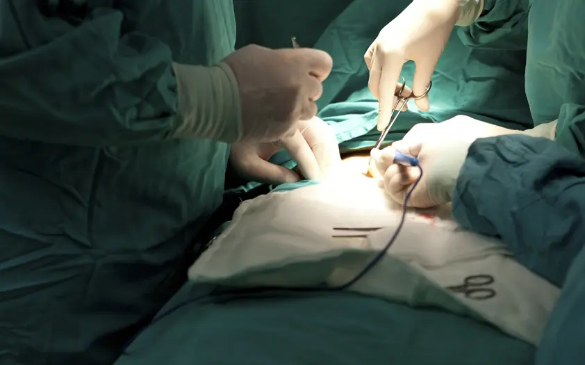 Extirpan con éxito un tumor de páncreas a un paciente trasplantado de hígado