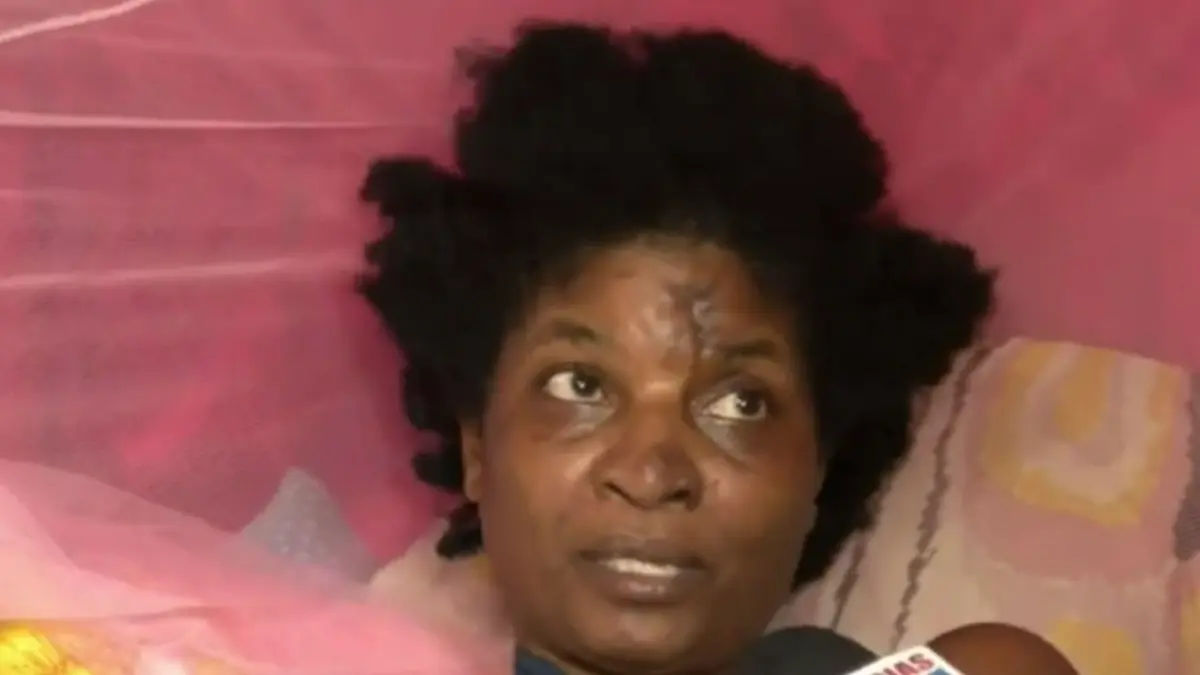 Mujer exige justicia tras ser atropellada por motociclistas