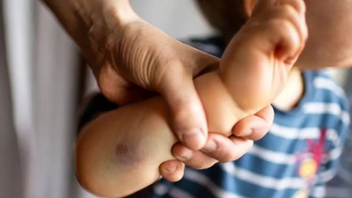 Denuncian mujer maltrata su hijo de cinco meses