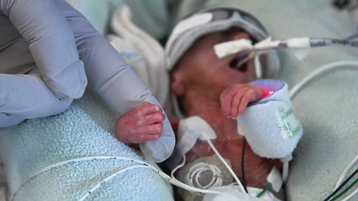 8 de cada 100 nacimientos en RD son prematuros