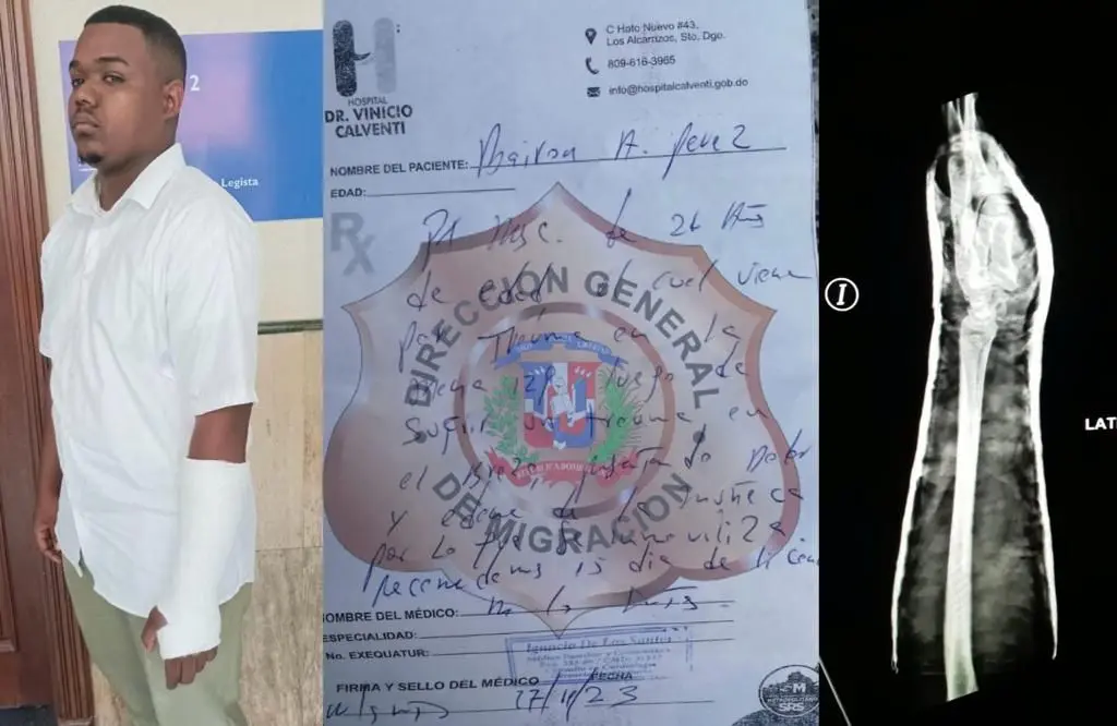 Migración aclara percance en que agente de la institución y ciudadano resultaron lesionados