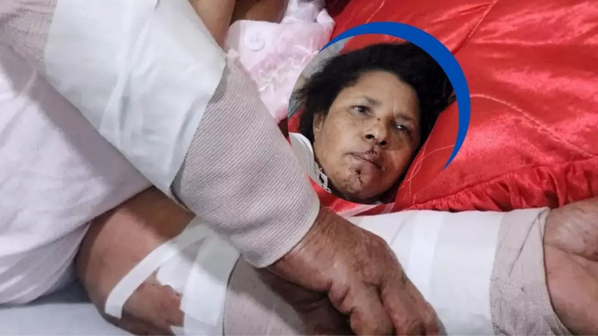 Dos perros pitbull atacan y hieren a una mujer en Santiago