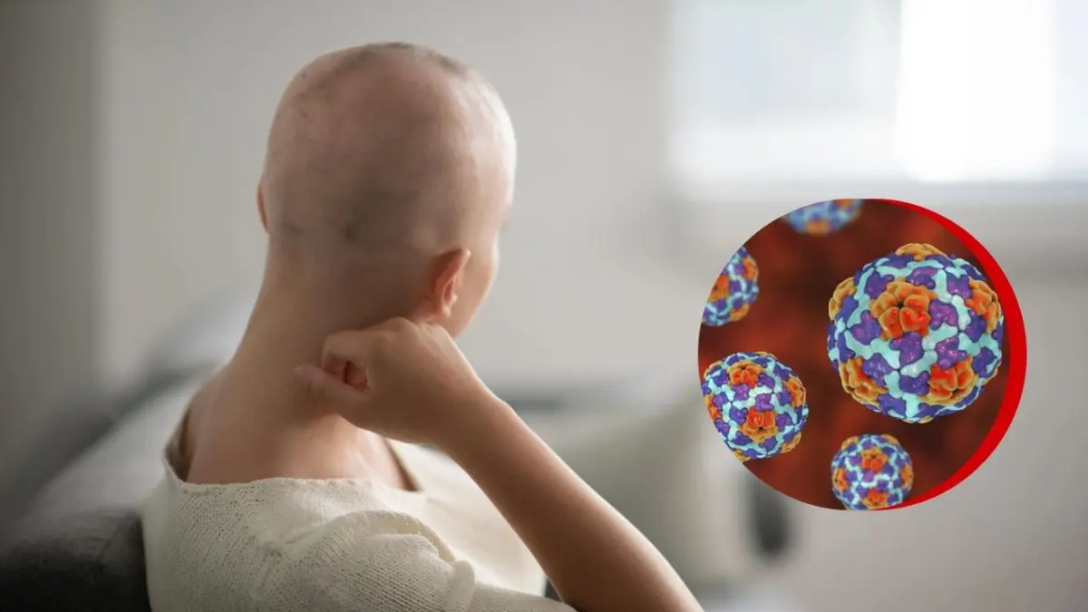 Descubren que tumor puede ser causado por virus