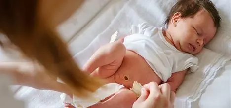 Mi bebé recién nacido de tres días hizo pipí como con sangre, ¿qué debo hacer?