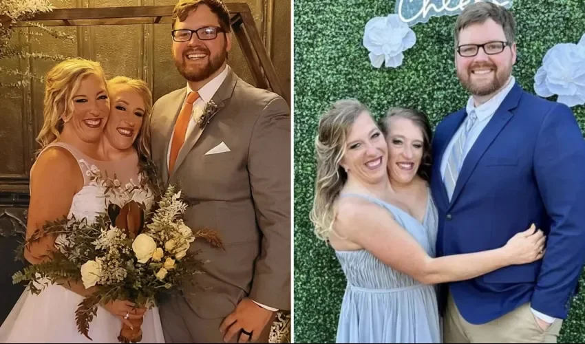 Abby Hensel, una de las famosas gemelas siamesas se casó