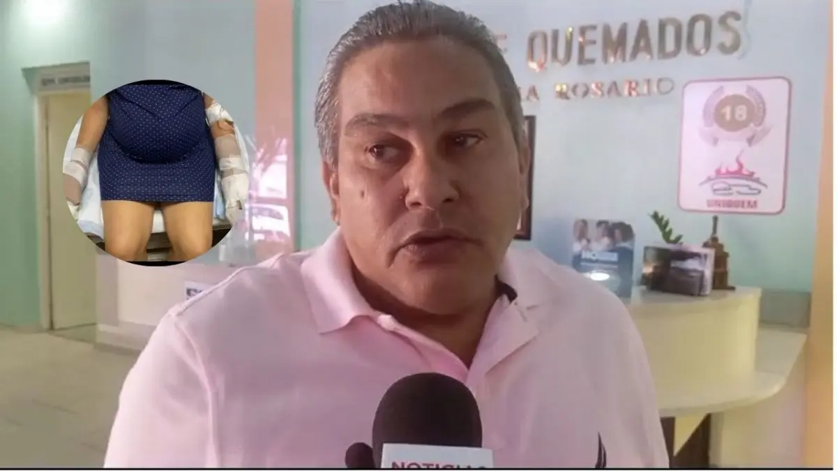 Se encuentra estable mujer embarazada que se quemó las manos tras quitarle disfraz en llamas a su hijo