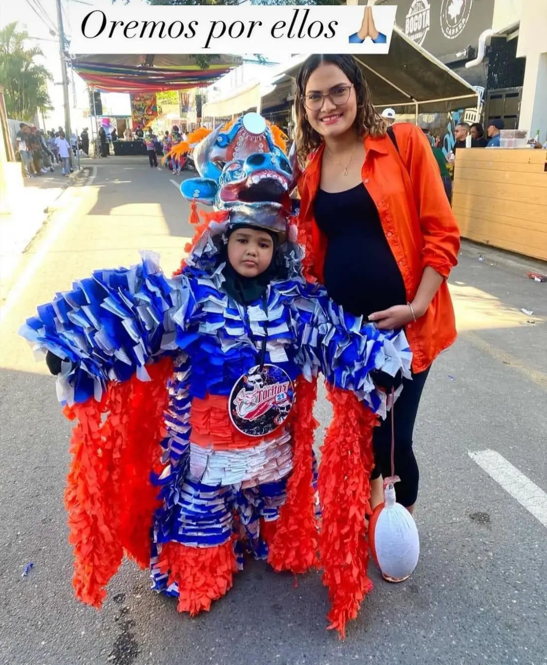 Fallece niño que resultó con quemaduras en Carnaval de Salcedo
