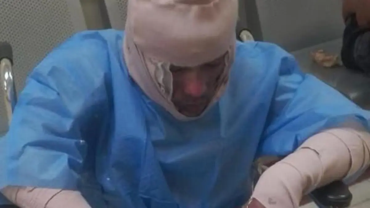 Continúa prófuga mujer que roció gasolina y prendió fuego a su pareja en Los Ríos