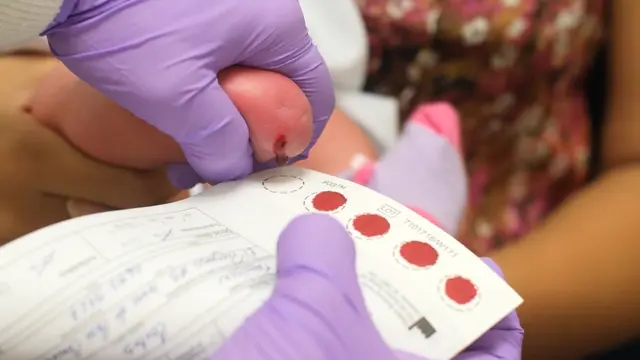 Importancia de la prueba de tamizaje neonatal