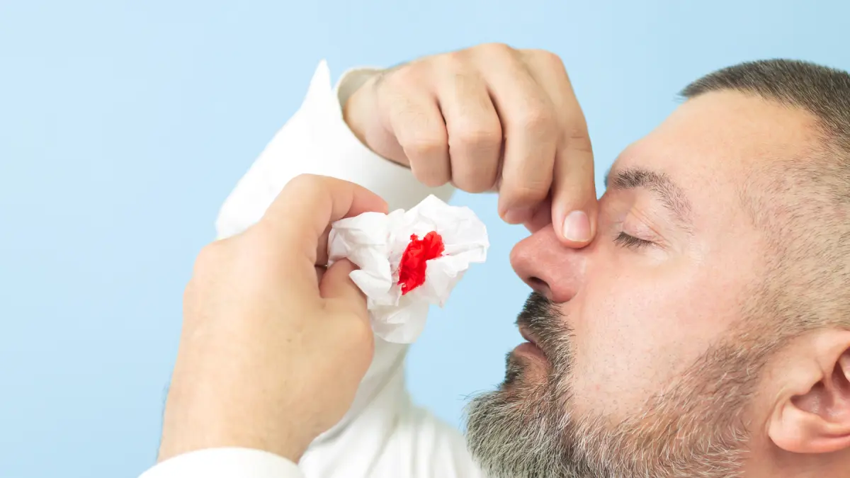 La hemofilia: un trastorno hemorrágico hereditario