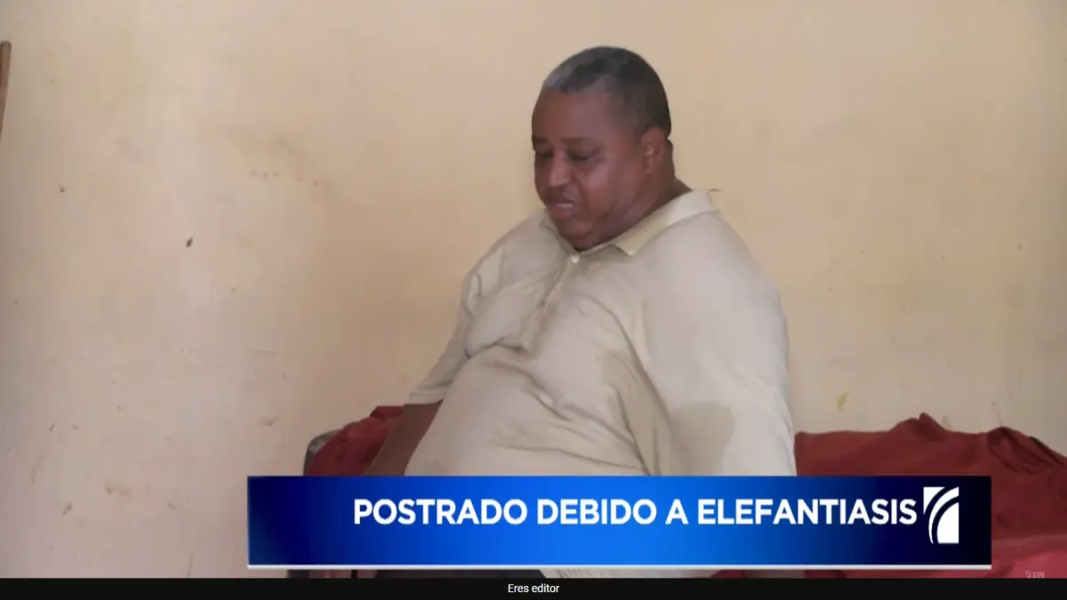 Elefantiasis trunca la carrera de un trompetista y lo deja postrado en cama