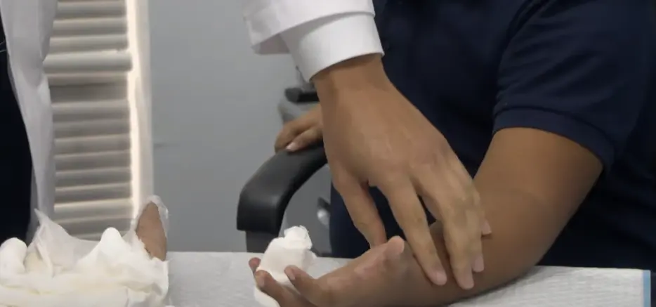 ¡Hito médico! Expertos en microcirugía reimplantan el dedo de un niño