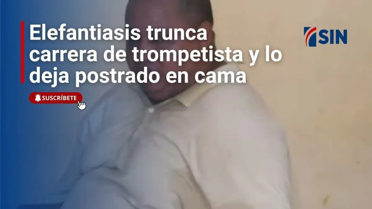 Elefantiasis trunca la carrera de un trompetista y lo deja postrado en cama.