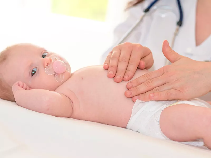 ¿Cuándo es recomendable operar una hernia en un niño?