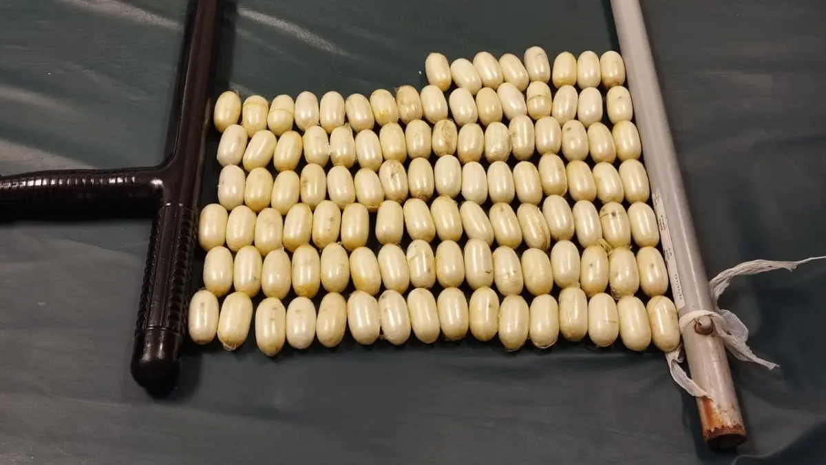 Arrestan extranjero con 104 bolsitas de presunta cocaína en el estómago
