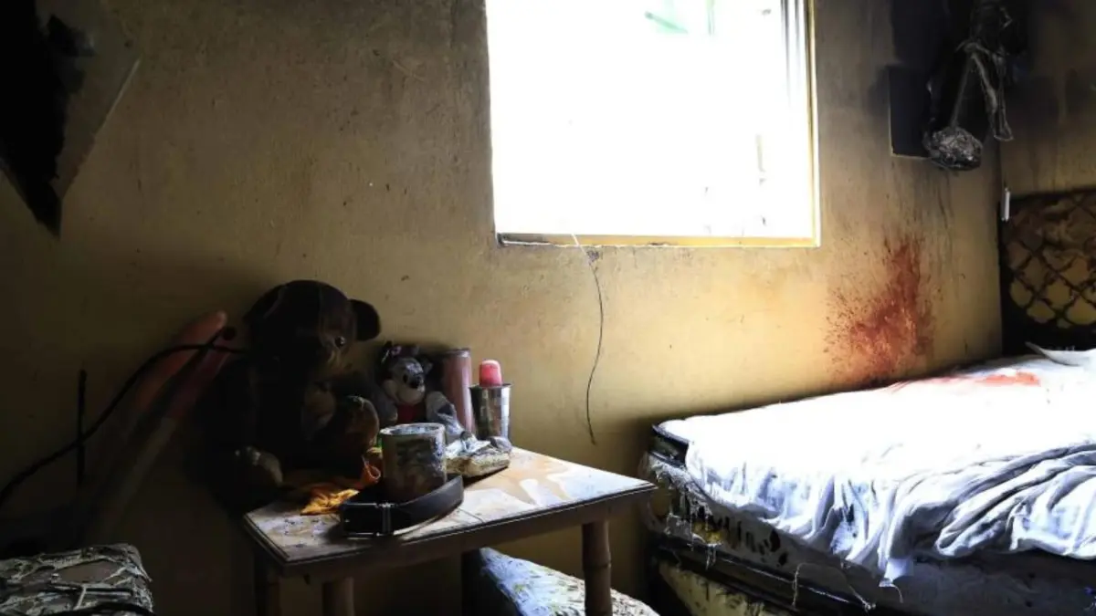 Muere hombre ultimó su pareja e incendió vivienda en Cristo Rey
