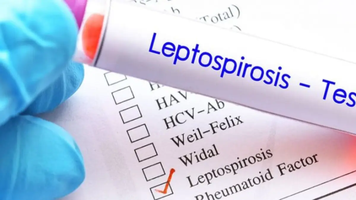 ¿Qué es la leptospirosis y cómo prevenirla?
