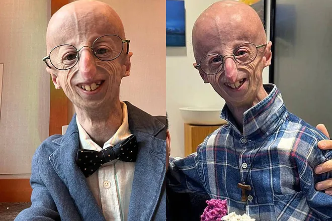 Fallece Sammy Basso, el joven con progeria que conmovió al Papa Francisco